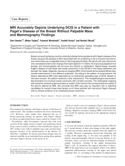 MRI Accurately Depicts Underlying DCIS in a Patient with Paget`s