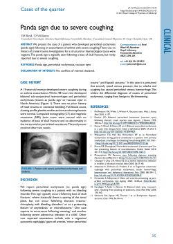 Panda sign due to severe coughing - Royal College of Physicians of