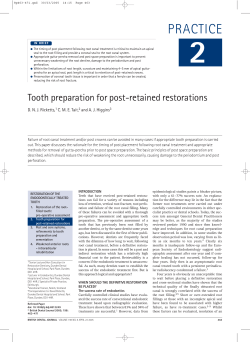 Tooth preparation for post