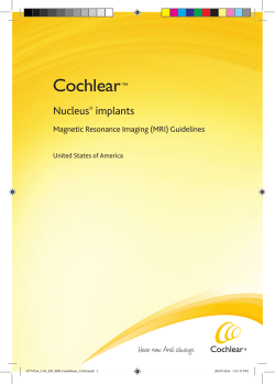 Nucleus&reg; implants