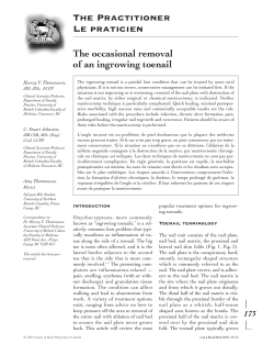 The occasional removal of an ingrowing toenail