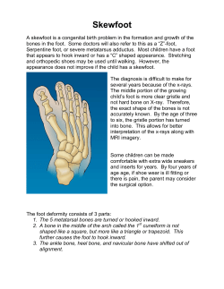Skewfoot - Orthopedics for Kids