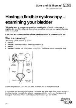 Flexible cystoscopy - Guy`s and St Thomas` NHS Foundation Trust