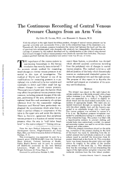 The Continuous Recording of Central Venous Pressure Changes