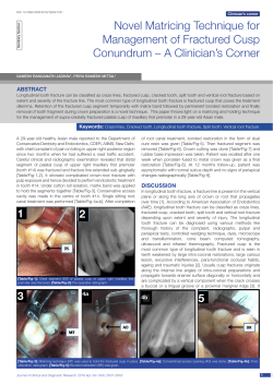 Novel Matricing Technique for Management of Fractured Cusp