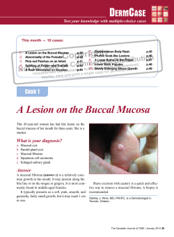 A Lesion on the Buccal Mucosa - STA HealthCare Communications