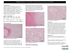 Case 1598.1 Fibrosarcoma in a Yellow Anaconda