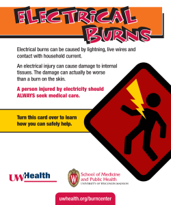 Electrical Burns