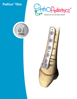 PediLoc&reg; Tibia - Fischer Medical