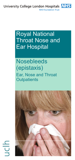 Royal National Throat Nose and Ear Hospital Nosebleeds