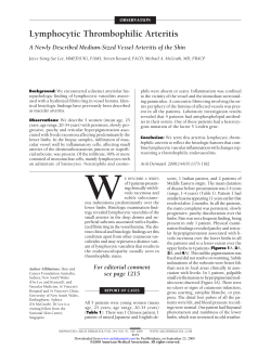 Lymphocytic Thrombophilic Arteritis