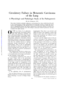 Circulatory Failure in Metastatic Carcinoma