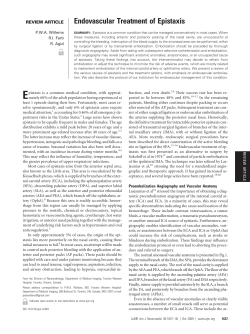 Endovascular Treatment of Epistaxis