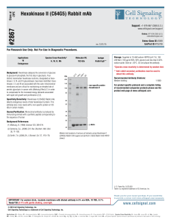 Hexokinase II (C64G5) Rabbit mAb