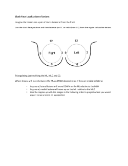 Clock Face Localization of Lesion: