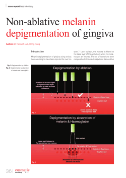 Non-ablative melanin depigmentation of gingiva