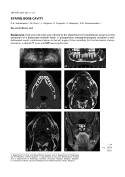 STAFNE BONE CAVITY A A B B C