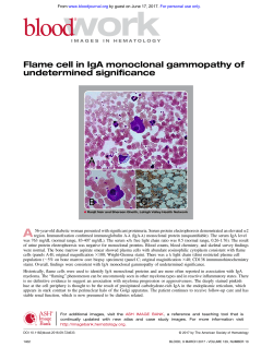 Flame cell in IgA monoclonal gammopathy of