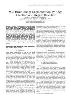 MRI Brain Image Segmentation by Edge Detection and Region