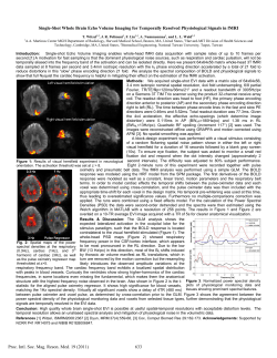 Single-Shot Whole Brain Echo Volume Imaging for