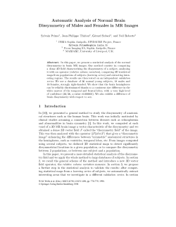 Automatic Analysis of Normal Brain Dissymmetry of Males and