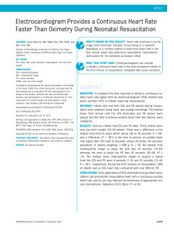 Electrocardiogram Provides a Continuous Heart Rate