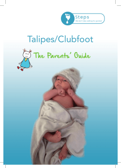 Talipes/Clubfoot