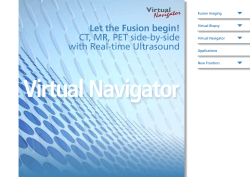 Let the Fusion begin! CT, MR, PET side-by-side with Real