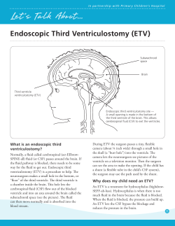 Endoscopic Third Ventriculostomy