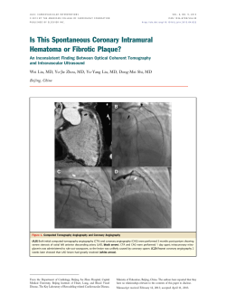 Is This Spontaneous Coronary Intramural Hematoma or Fibrotic