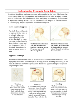 Understanding Traumatic Brain Injury