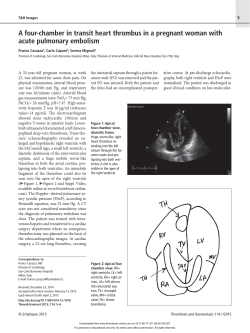 A four-chamber in transit heart thrombus in a pregnant woman with