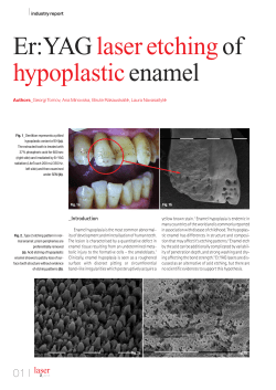 Er:YAG laser etching of hypoplastic enamel