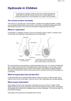 Hydrocele in Children