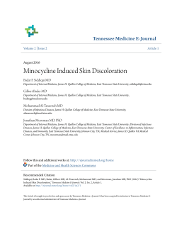 Minocycline Induced Skin Discoloration