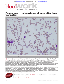 Passenger lymphocyte syndrome after lung transplant