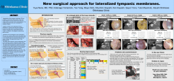 New surgical approach for lateralized tympanic membranes.