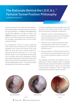The Rationale Behind the IDEAL&trade; Femoral Tunnel