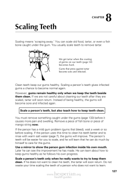 Scaling Teeth - iEmpowerment