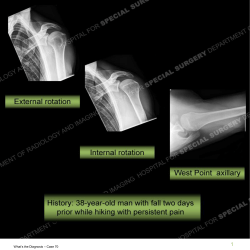 Case 70