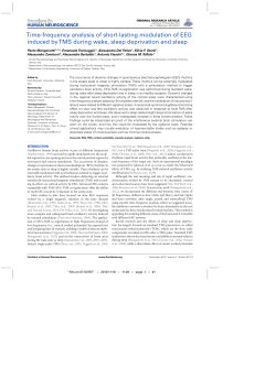 Time-frequency analysis of short-lasting modulation of