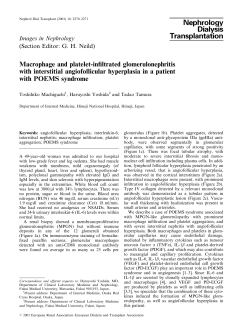 Macrophage and platelet-infiltrated glomerulonephritis with