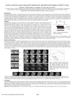 Fast time-resolved cine sequence using temporal