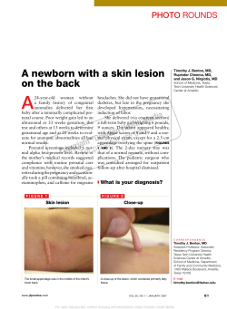 a newborn with a skin lesion on the back
