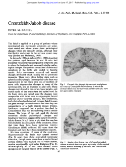 Creutzfeldt-Jakob disease - Journal of Clinical Pathology