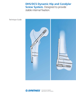 DHS/DCS Dynamic Hip and Condylar Screw System TG