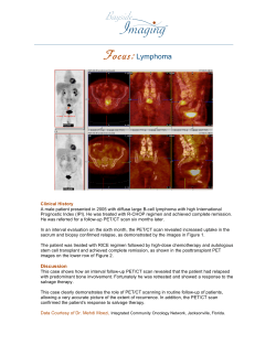 Case Study Lymphoma