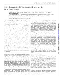 Every slow-wave impulse is associated with motor activity of the