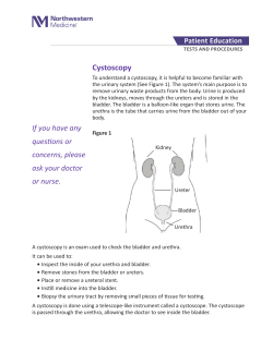 Cystoscopy - Northwestern Medicine