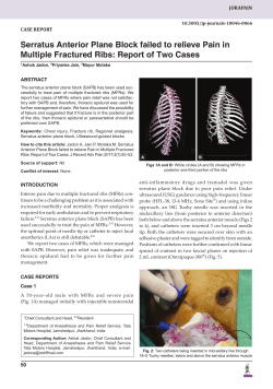 Serratus Anterior Plane Block failed to relieve Pain in Multiple
